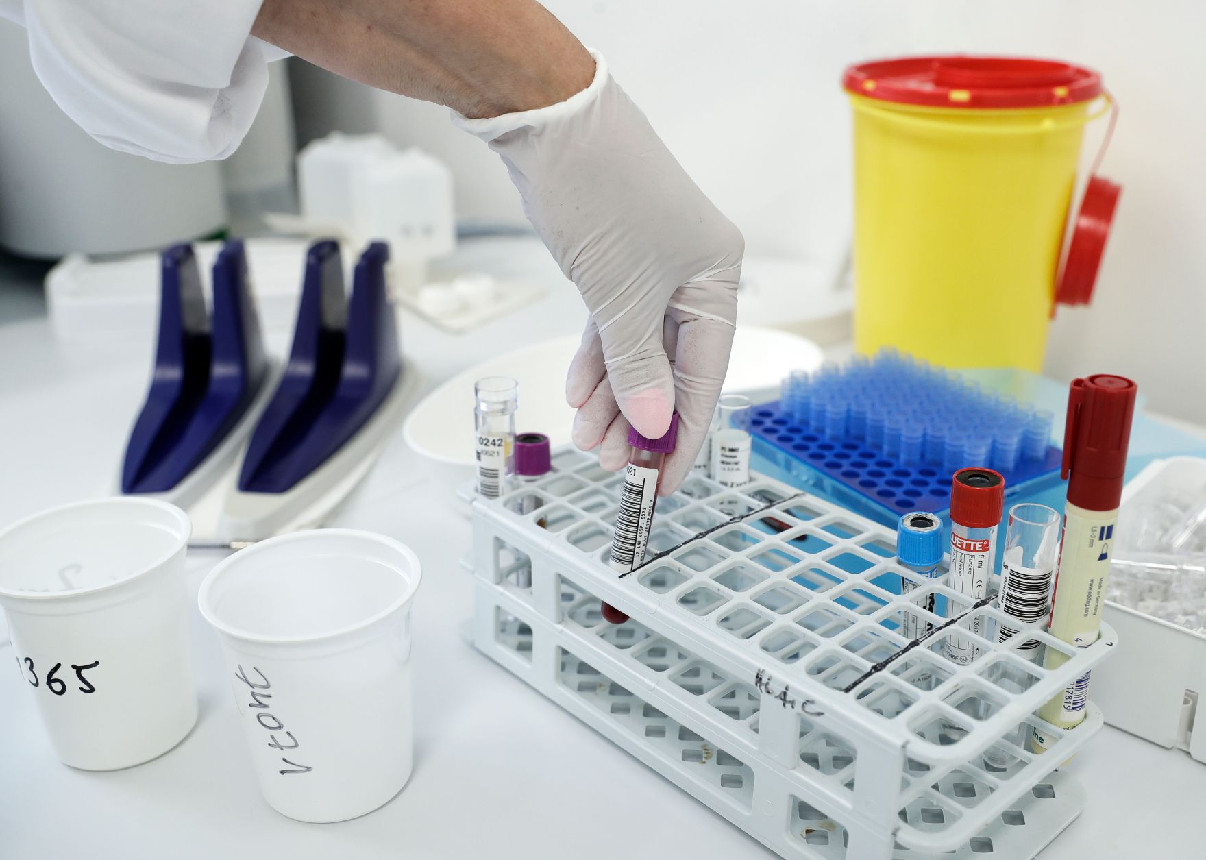 Labor - verschiedene Proben werden gesammelt. Schlagw&ouml;rter: Medizin, Blutprobe, Untersuchung, Latex Handschuhe, Gesundheit, Arzt, Rat f&uuml;r Besch&auml;ftigung, Sozialpolitik, Gesundheit und Verbraucherschutz, EPSCO