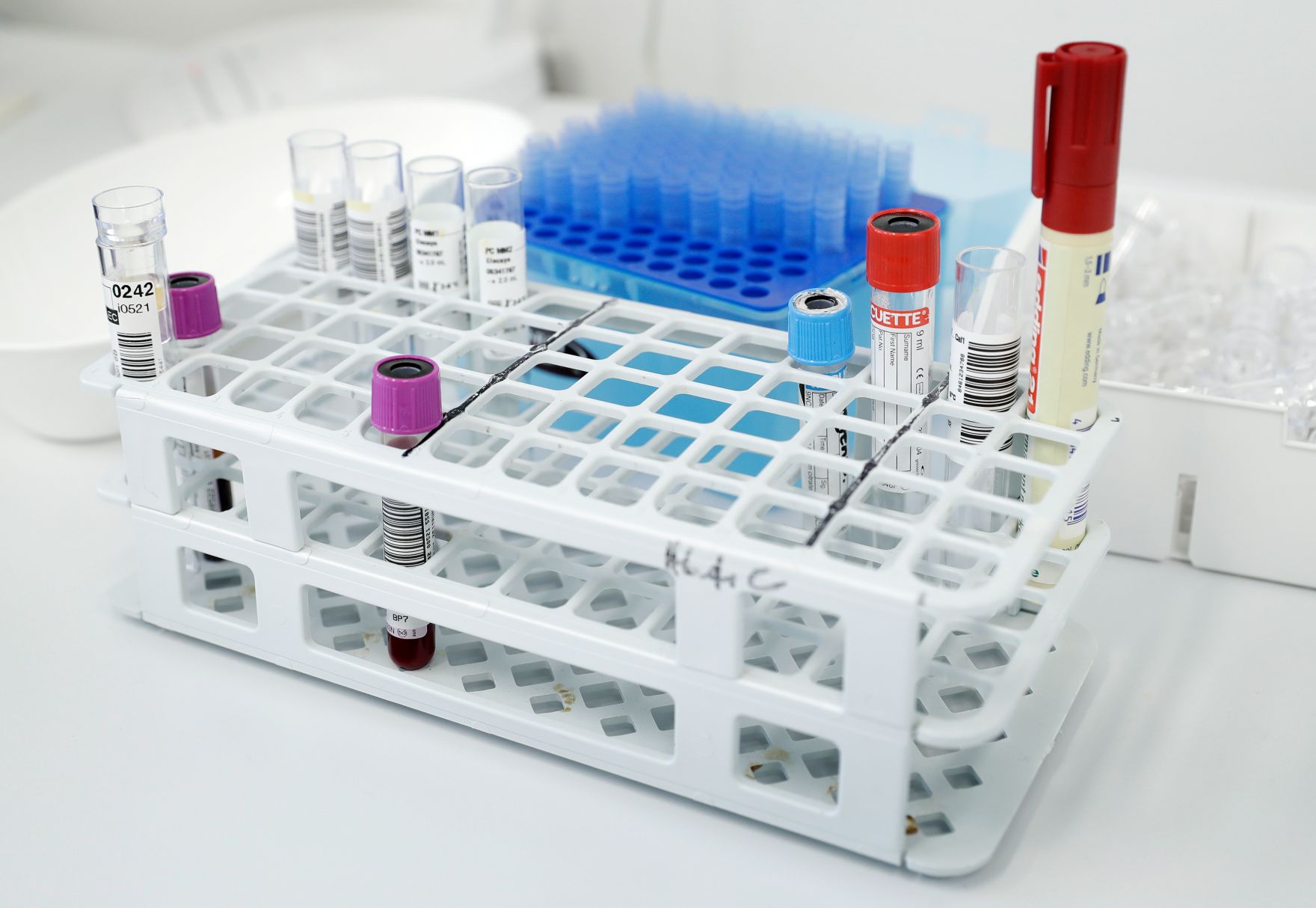 Labor - verschiedene Proben werden gesammelt. Schlagw&ouml;rter: Medizin, Blutprobe, Untersuchung, Latex Handschuhe, Gesundheit, Arzt, Rat f&uuml;r Besch&auml;ftigung, Sozialpolitik, Gesundheit und Verbraucherschutz, EPSCO