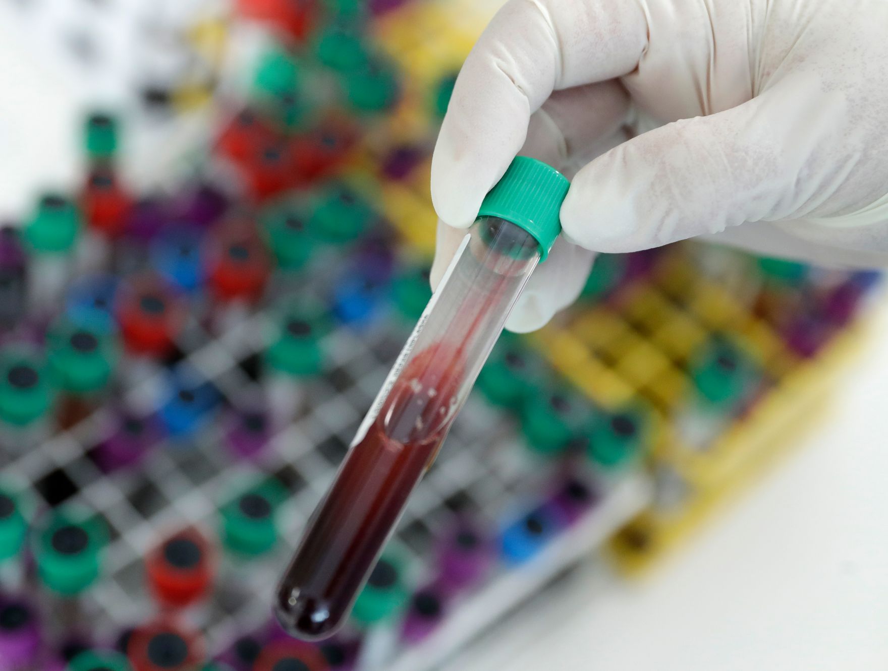 Labor - Eine Blutprobe im Reagenzglas. Schlagw&ouml;rter: Medizin, Untersuchung, Gesundheit, Arzt, Rat f&uuml;r Besch&auml;ftigung, Sozialpolitik, Gesundheit und Verbraucherschutz, EPSCO