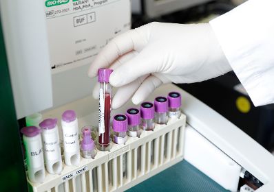 Labor - verschiedene Proben in Reagenzgl&auml;sern. Schlagw&ouml;rter: Medizin, Reagenzgl&auml;ser, Untersuchung, Gesundheit, Arzt, Rat f&uuml;r Besch&auml;ftigung, Sozialpolitik, Gesundheit und Verbraucherschutz, EPSCO