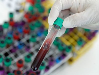 Labor - Eine Blutprobe im Reagenzglas. Schlagw&ouml;rter: Medizin, Untersuchung, Gesundheit, Arzt, Rat f&uuml;r Besch&auml;ftigung, Sozialpolitik, Gesundheit und Verbraucherschutz, EPSCO