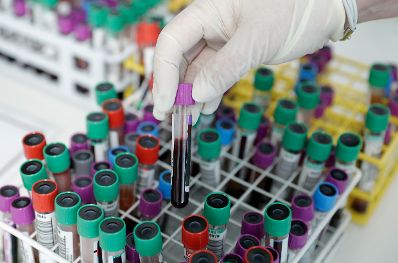 Labor - Eine Blutprobe im Reagenzglas. Schlagw&ouml;rter: Medizin, Untersuchung, Gesundheit, Arzt, Rat f&uuml;r Besch&auml;ftigung, Sozialpolitik, Gesundheit und Verbraucherschutz, EPSCO